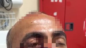 Hakkari'de tarlasına gitti iki ayının saldırısına uğradı