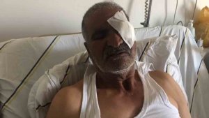 Iğdır'daki yayla saldırısında ağır yaralanan kişi saldırı anlarını anlattı