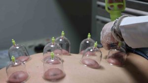 Yanlış uygulanan hacamat ömür boyu geçmeyen yaralar ve ağrılar oluşturuyor