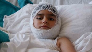 Pilav kazanına düşerek yanan Nahçıvanlı çocuk Erzurum'da tedavi ediliyor