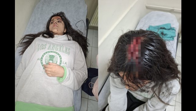 Hakkari'de başına buz kütlesi düşen genç kız yaralandı