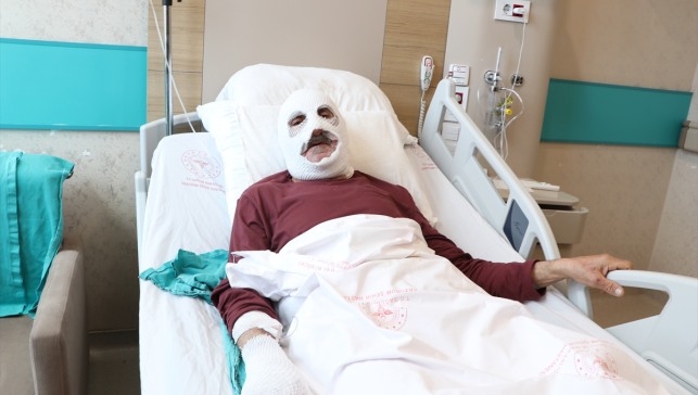 Tüpteki gaz kaçağını çakmakla kontrol edince hastanelik oldu