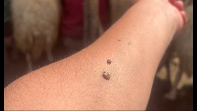 Erzincan'da KKKA uyarısı: Kene temasına karşı dikkatli olun!