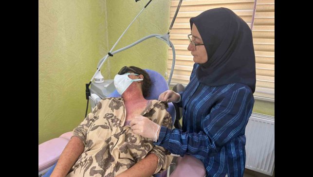 Van'da 'beyazlatıcı krem' faciası: 4 kişi hastanelik oldu