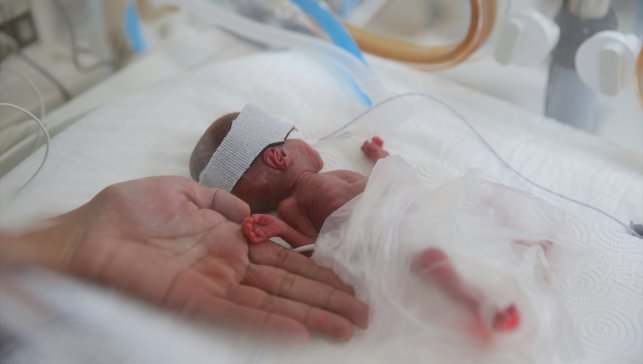 Prematüre bebekler, sağlık çalışanlarının çabasıyla hayata tutunuyor