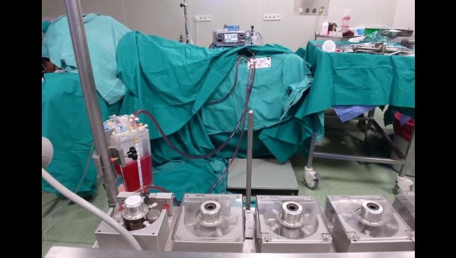 Elazığ'da HIPEC yöntemi ile kanser tedavisi uygulanıyor