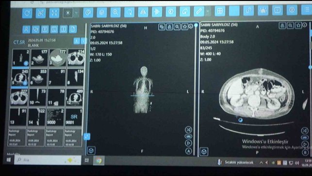Van'dan dünyaya örnek çalışma: Kanser tedavisinde yapay zekâ kullanıldı