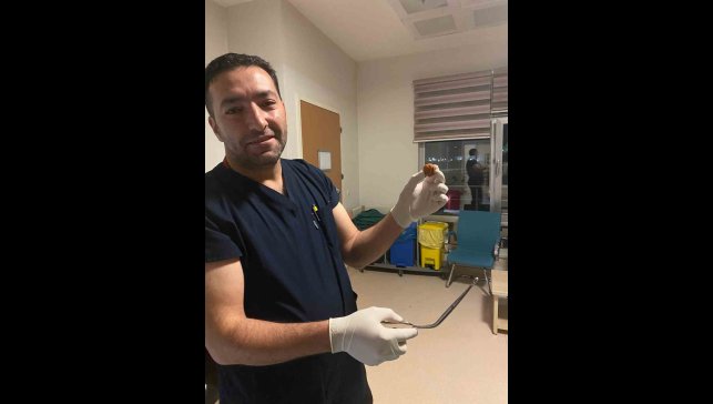 Ağrı'da yuttuğu ceviz yemek borusundan çıkarıldı