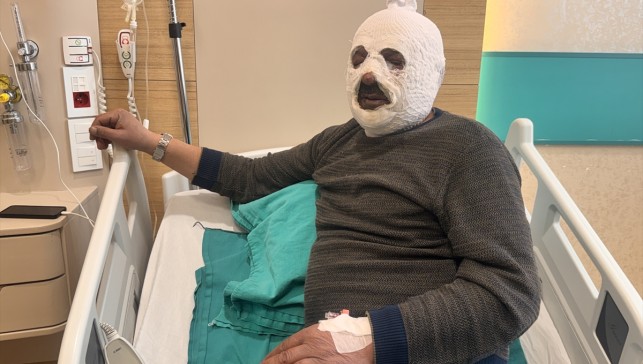 Kalorifer kazanını yakmak için döktüğü benzin az daha canından ediyordu