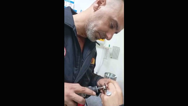 Sıkışan yüzük itfaiye ekiplerince çıkarıldı