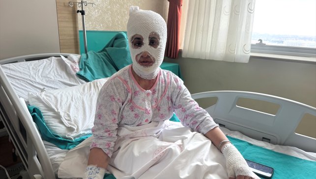 Ağrı’da düdüklü tencere patladı, Genç kadın ağır yaralandı