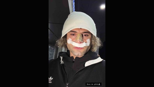 Elazığspor'da Fuat Bavuk'un burnu kırıldı