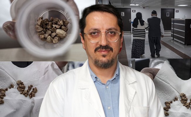Erzurum'da sıra dışı operasyon! 31 yaşındaki kadının üreterinden 51 taş çıkarıldı