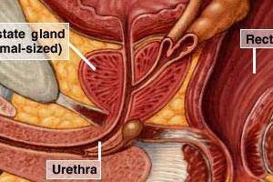 Prostat hakkında bilinmeyenler