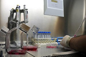 kolesterolü Yükselten Artıran Gıdalar Yiyecekler