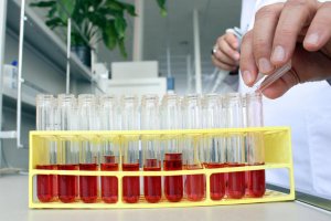 Hemofili hastalarına yeni umut