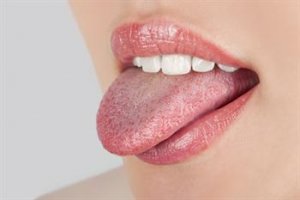 Ağız Kuruluğu Diş Ve Diş Eti Hastalıklarına Zemin Hazırlıyor