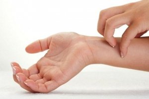 Egzama Nedir Ve Neden Olur?