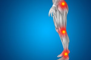 Romatizma Hastalığın Sebepleri ve Tedavi Yöntemleri