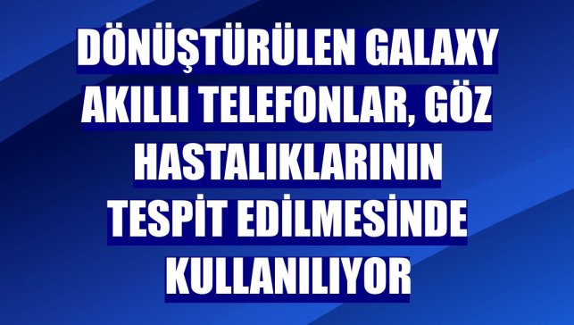 Dönüştürülen Galaxy akıllı telefonlar, göz hastalıklarının tespit edilmesinde kullanılıyor