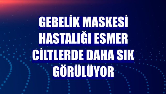 Gebelik maskesi hastalığı esmer ciltlerde daha sık görülüyor