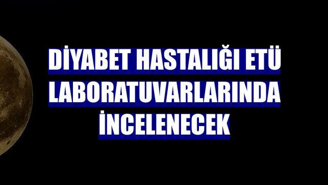 Diyabet hastalığı ETÜ laboratuvarlarında incelenecek