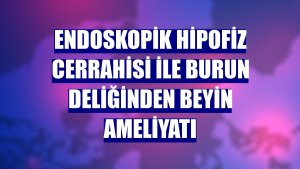 Endoskopik hipofiz cerrahisi ile burun deliğinden beyin ameliyatı