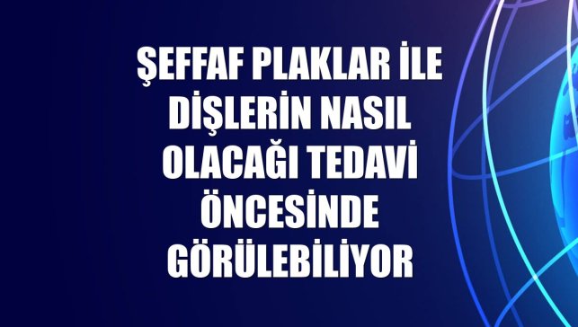 Şeffaf plaklar ile dişlerin nasıl olacağı tedavi öncesinde görülebiliyor
