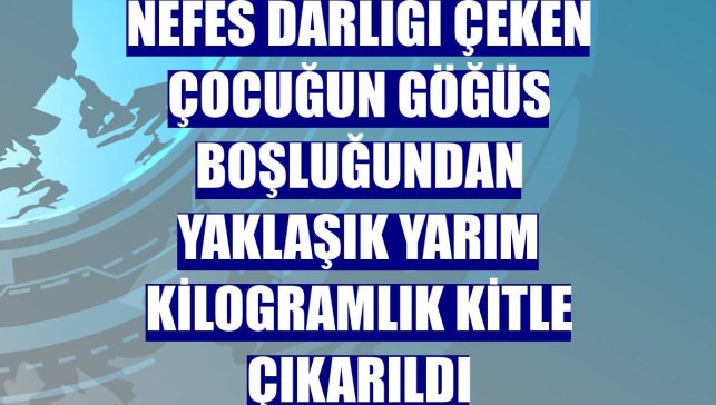 Nefes darlığı çeken çocuğun göğüs boşluğundan yaklaşık yarım kilogramlık kitle çıkarıldı