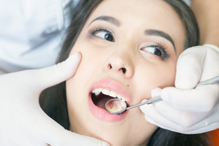 diş apsesi nasıl tedavi edilir