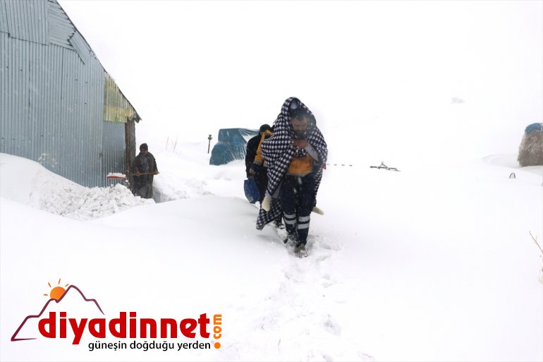 AĞRI Kar kadını - hastaneye tipide ve saatte felçli ulaştırdılar 4 7