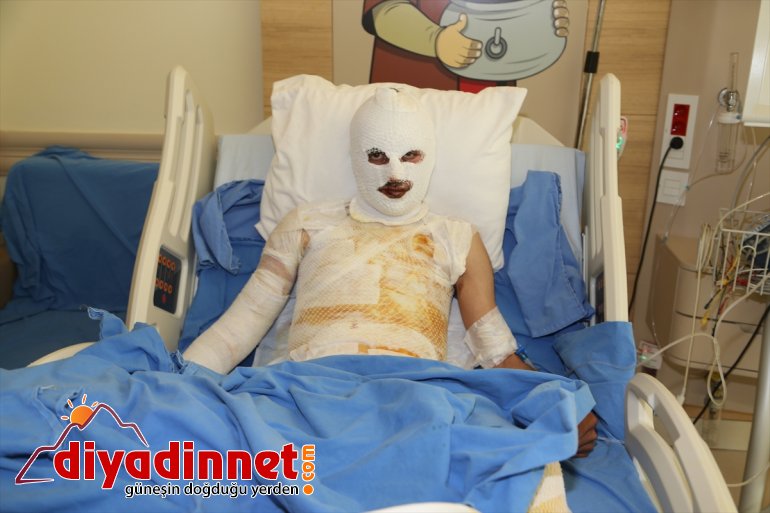 Yıldırım düşmesi sonucu aynı gün farklı yerlerde yaralanan 2 çoban tedavi ediliyor