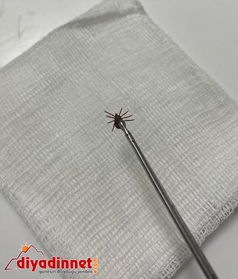 şikayetiyle zarından çıktı kulak ağrı kadının Erzincan