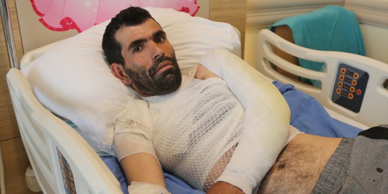 Banyo yaparken sıcak suyla yanan Erzurumlu Yasin Ergeni'nin tedavisi sürüyor