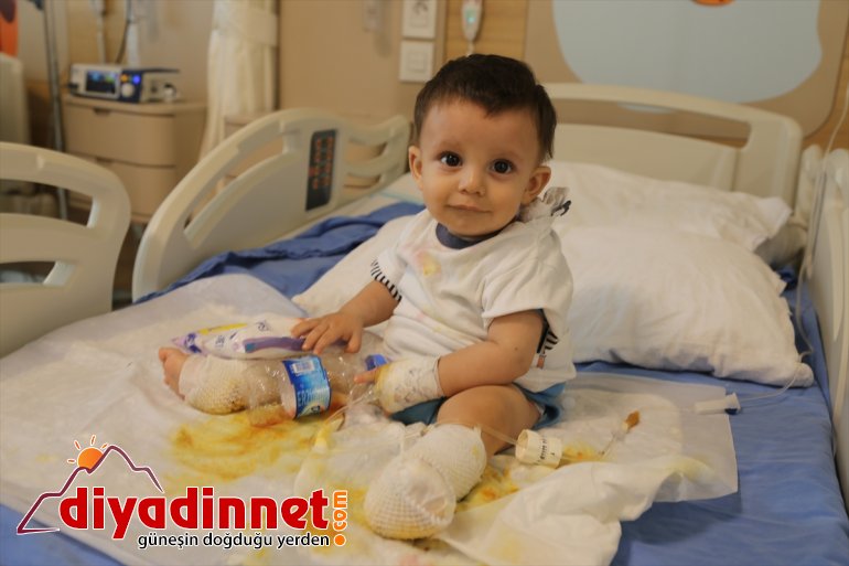 Üzerine su - kaynar bebek alındı tedaviye devrilen çaydanlık ERZURUM dolu 2