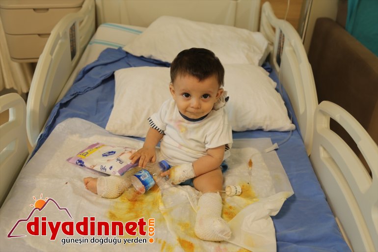 ERZURUM çaydanlık bebek Üzerine su kaynar - alındı dolu tedaviye devrilen 3