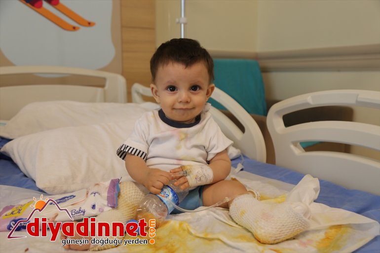 su tedaviye Üzerine bebek alındı ERZURUM kaynar devrilen dolu çaydanlık - 4