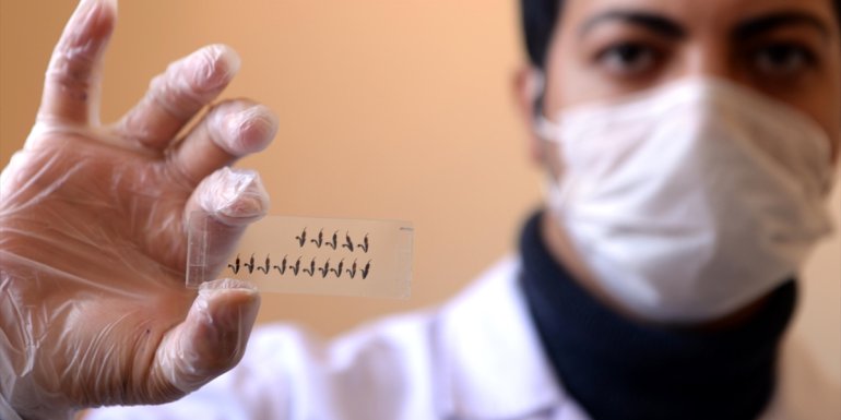 Tescilli "Ardahan çiçek balı"nın kalitesi analizlerle korunuyor