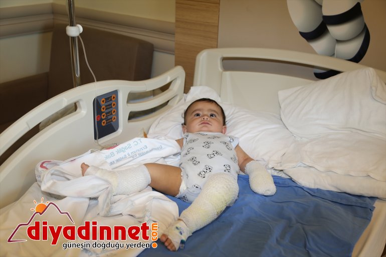 Ağrı'da üzerine kaynar su dolu çaydanlık devrilen bebek yaralandı
