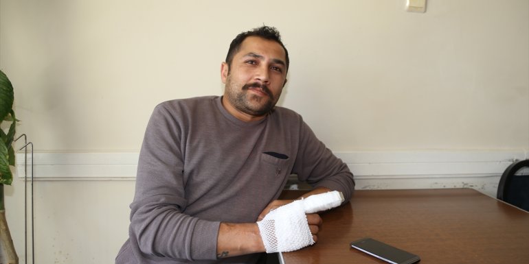 Şarj cihazının patlamasıyla parmağı kopan Erzurumlu hasta yaşadığı korkuyu unutamıyor