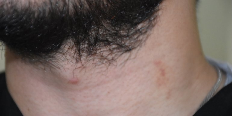 Kars'ta hasta yakını tarafından darbedildiği öne sürülen sağlık çalışanı şikayetçi oldu