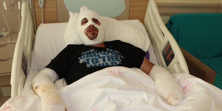 Artvin'de kafede çıkan yangında ağır yaralanan Tolga Topal, yaşadıklarını anlattı: