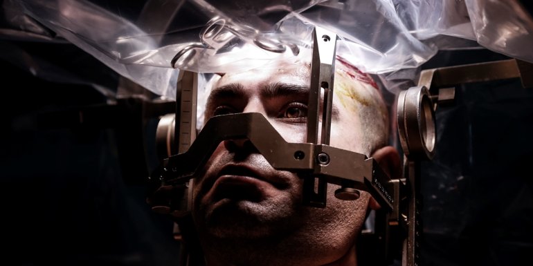 Guinness rekortmeni Doç. Dr. Ali Zırh, 1.000'inci Parkinson ameliyatını yaptı