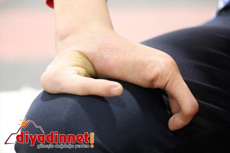 Sporla doğuştan engelli hayata olmak Sezer, AĞRI tutunan istiyor - örnek 11