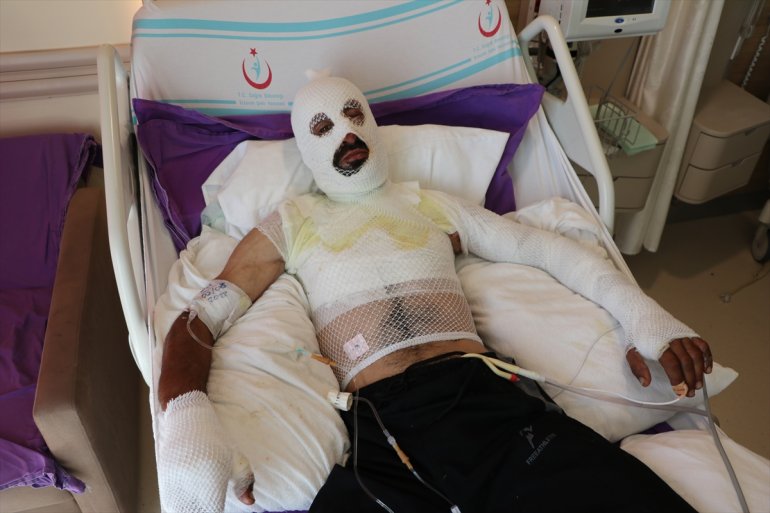 Elektrik akımına kapılan sürüdeki koyunları kurtarırken ölümden döndü