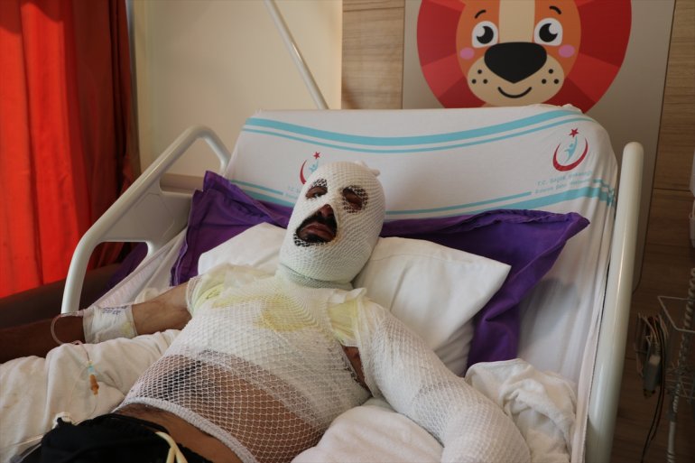 kapılan kurtarırken döndü akımına ERZURUM ölümden - Elektrik koyunları sürüdeki 3