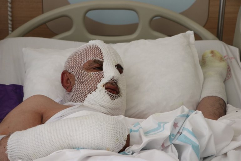 Tıkalı lavaboyu kimyasal ürünle açma denemesi hastanelik etti