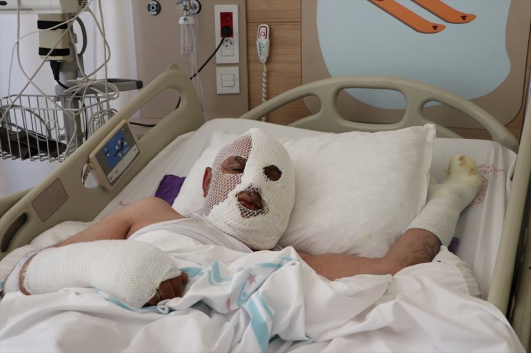 kimyasal hastanelik - ERZURUM ürünle Tıkalı açma etti denemesi lavaboyu 2