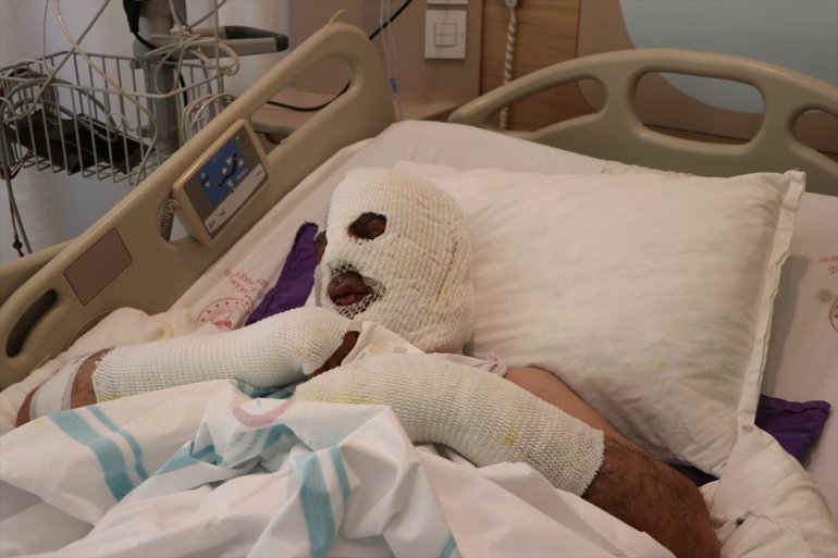 - açma denemesi ERZURUM kimyasal lavaboyu hastanelik Tıkalı ürünle etti 3