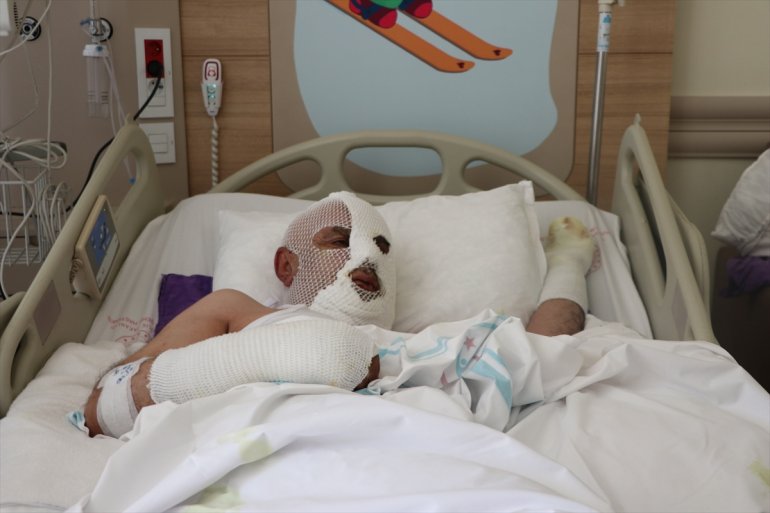 lavaboyu açma denemesi kimyasal - Tıkalı hastanelik ERZURUM etti ürünle 4